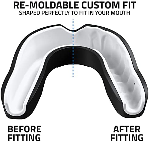 Titanium Sports Premium Mouth Guard - Slim Fit Sports Mouth Guard with Case - Gum Shield for Jaw Protection in Contact Sports - Durable Boxing, MMA, Judo, Karate, Rugby, Hockey, Football Mouthguard - Image 3