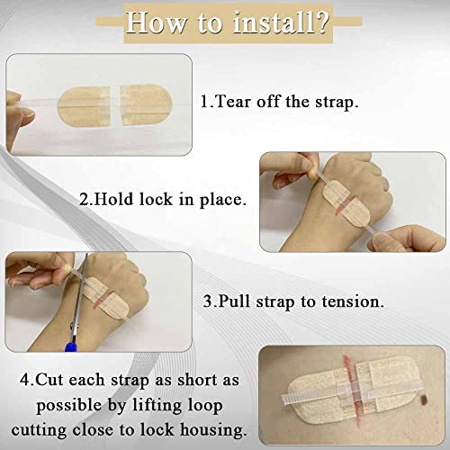 Emergency Wound Closures Band-Aid Adhesive Bandages, Zip Stitch Stickers for Camping, Survival & Household Gear, 3 Pcs (45*10mm, Skin) - Image 5